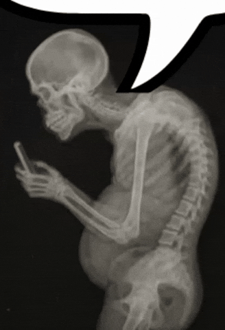 Bad Posture GIF